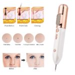 Blue Light Acne Beauty Instrument - Image 5