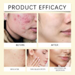 Turmeric Kojic Acid Cleansing Gasket Face Daily Cleaning - Image 4