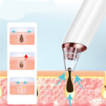 Electric blackhead cleansing instrument - Image 2