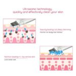 Ultrasonic Skin Scrubber Face Cleanser Blackhead Acne Removal Facial Spa Vibration Massager Ultrasound Peeling Clean Machine 394 - Image 4